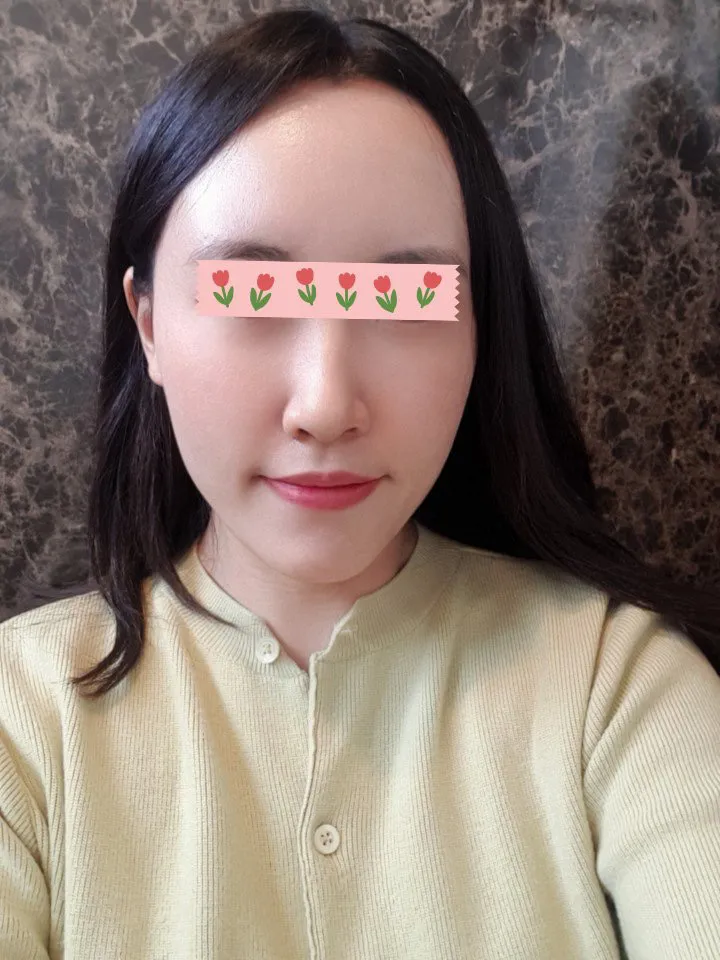 術後