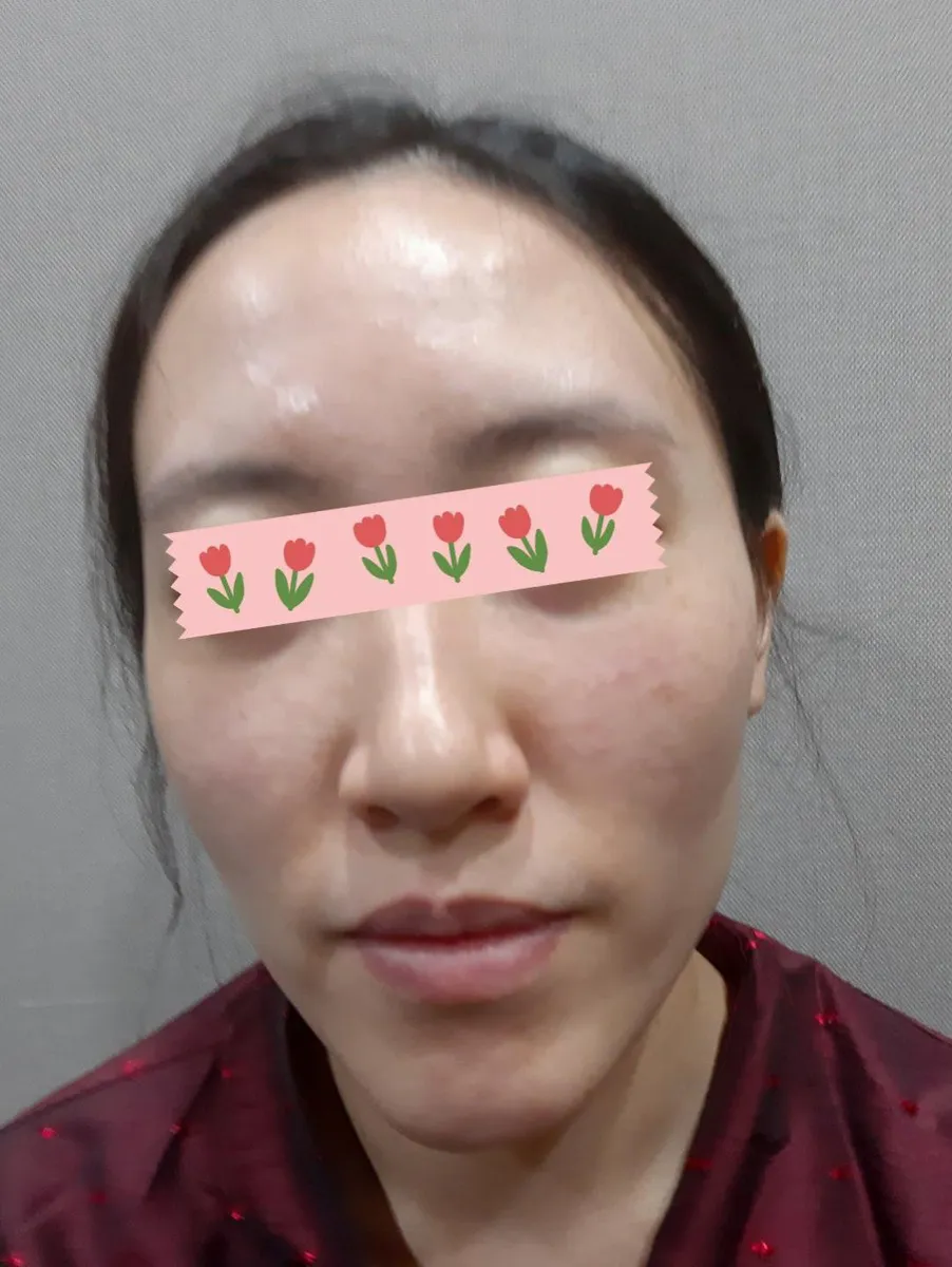 術前